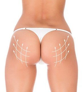 Brazilian Butt Lift Tri Pak ampoules — professional glute lifting mesotherapy | SlimSpa