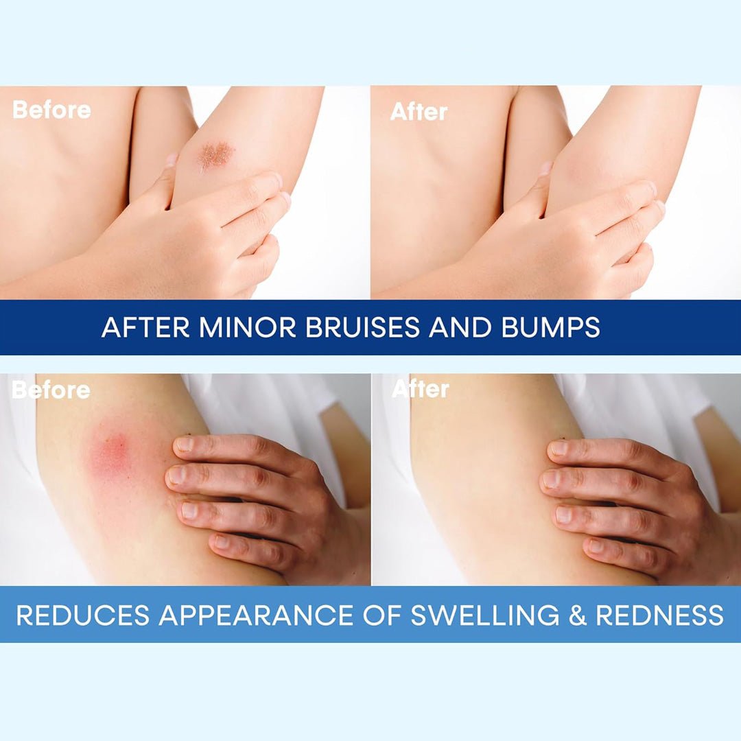 Bruise & Scar Organic Cream packaging — professional retail post-surgical care, wholesale USA