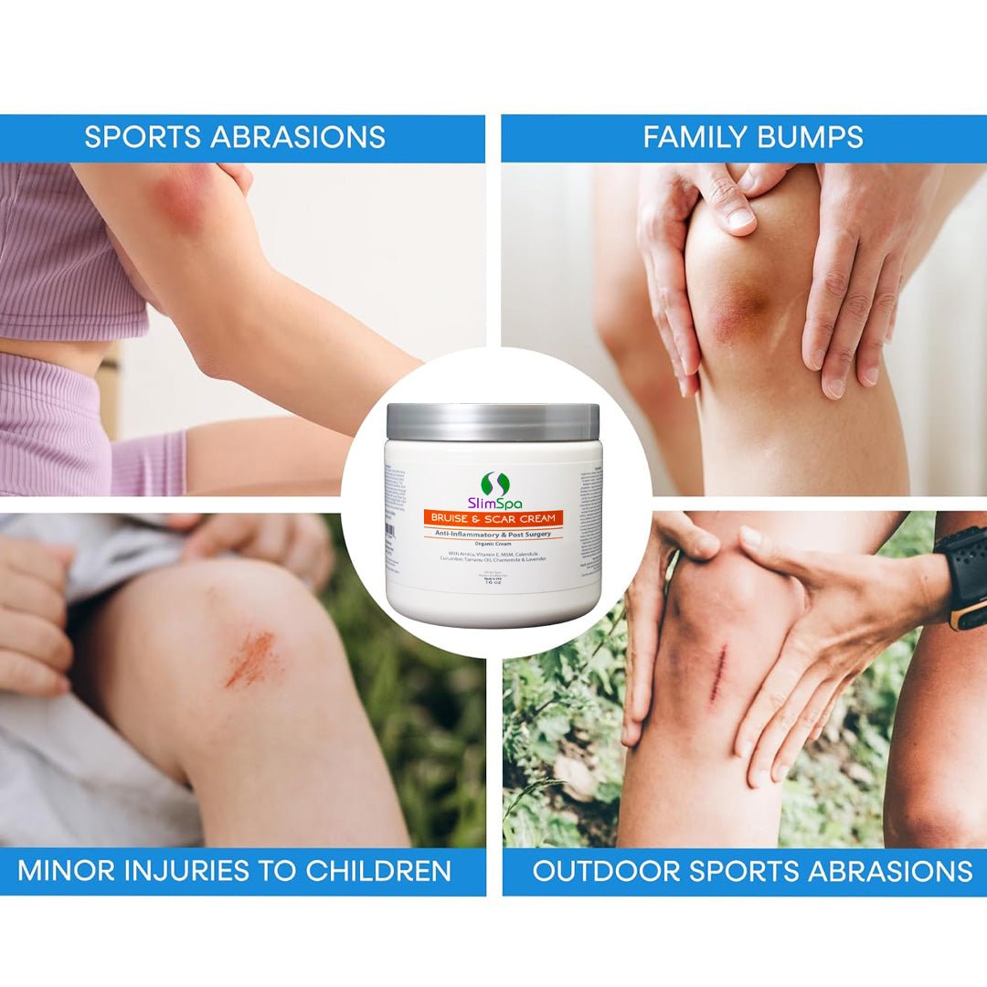 Bruise & Scar Organic Cream jar — Arnica, Vitamin E & MSM formula, professional wholesale spa retail