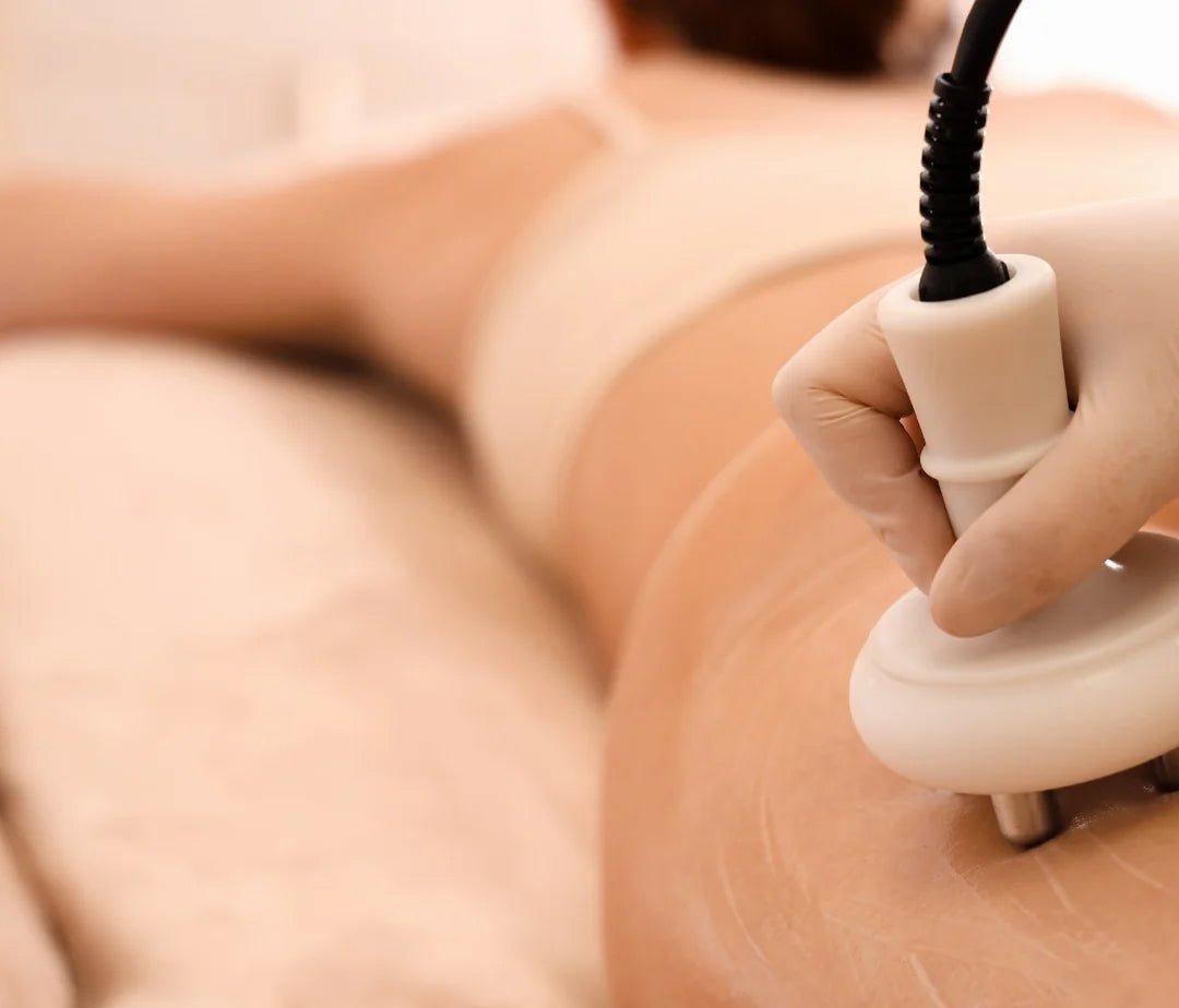 Electroporation device in professional use — needle-free mesotherapy treatment | SlimSpa