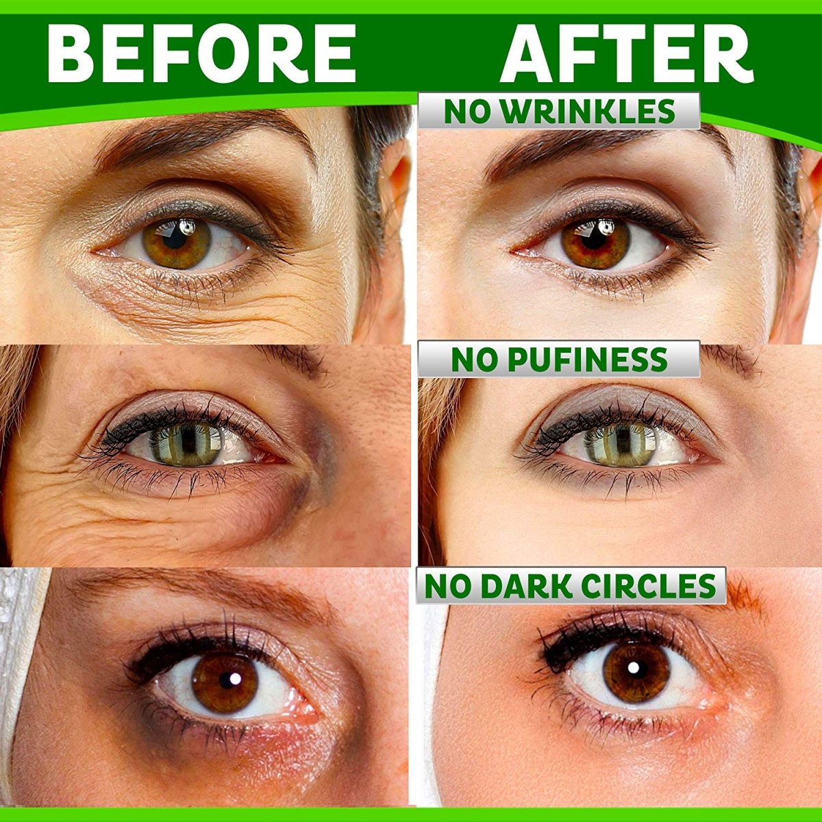 Eye Care Combo contents — Eye Complex Cream & Dark Circle Eye Cream with Q10, professional wholesale spa