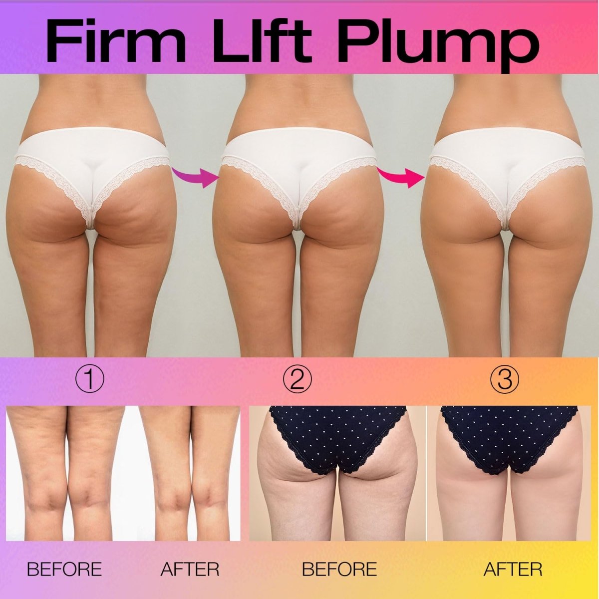 BBL Booty Protocol Vials close-up — 5 vials 10ml non-invasive booty contouring mesotherapy | SlimSpa