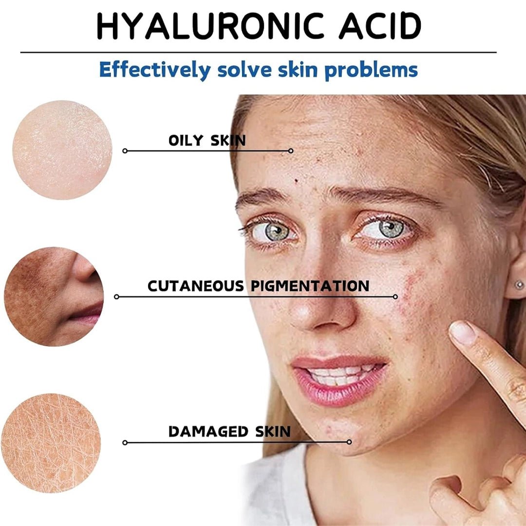 Hyaluronic Acid Plus 1% used in professional treatment series — mesotherapy hydration | SlimSpa