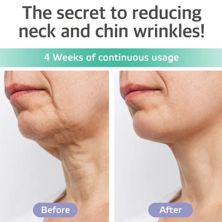 Neck Firming Cream ingredients — DMAE, Retinol, HA + Collagen + CoQ10 for licensed estheticians | SlimSpa
