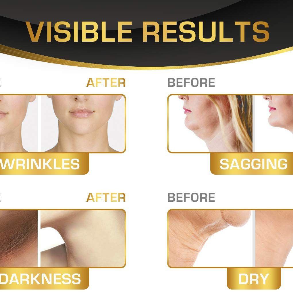 Neck Firming & Double Chin Cream professional use — finishing step for facial & anti-aging protocols | SlimSpa