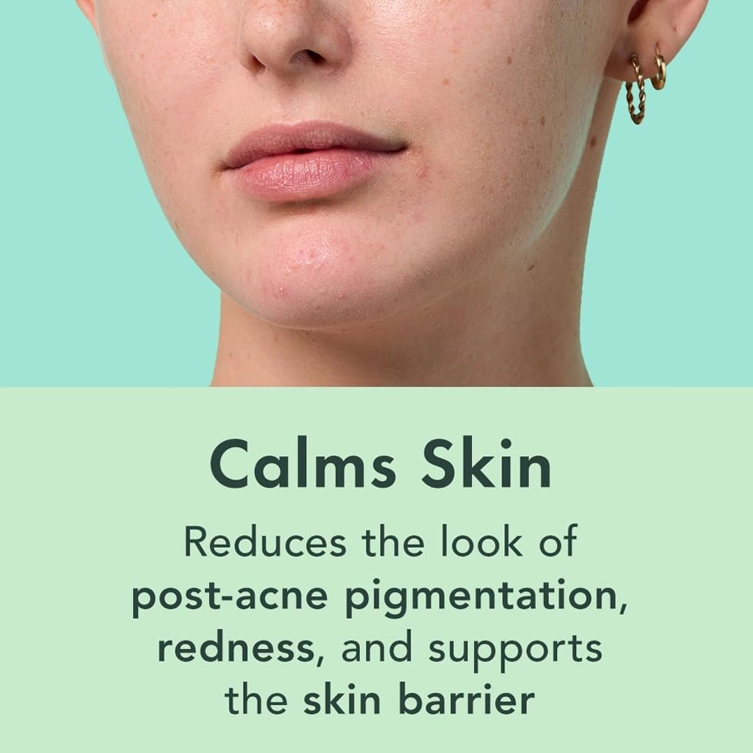 Oil Be Gone Botanical Serum application — spot treatment for licensed esthetician clients, wholesale