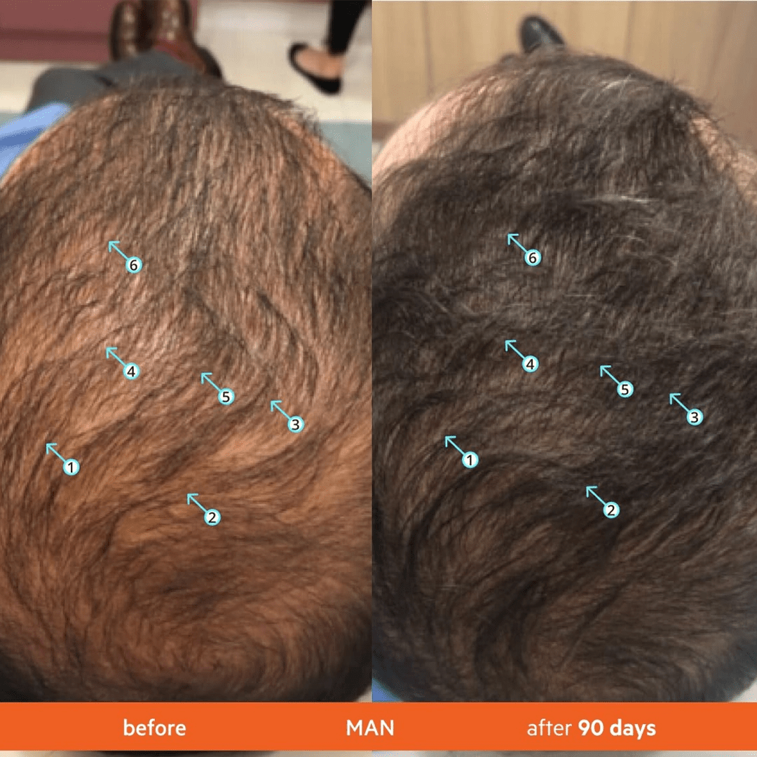 ReGROWTH Exosome Hair Serum 30 ml. - SlimSpaOnline