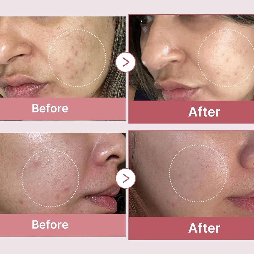 Salmon DNA Serum 30ml on skin — professional PDRN serum for visible radiance & skin plumping results | SlimSpa
