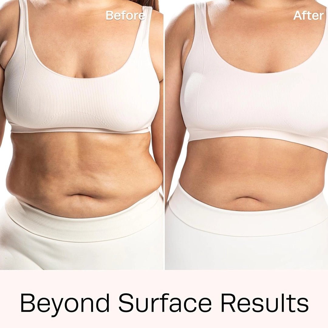 Slim Cell Concentrate skin application — professional cellulite & slimming pre-treatment, wholesale spa