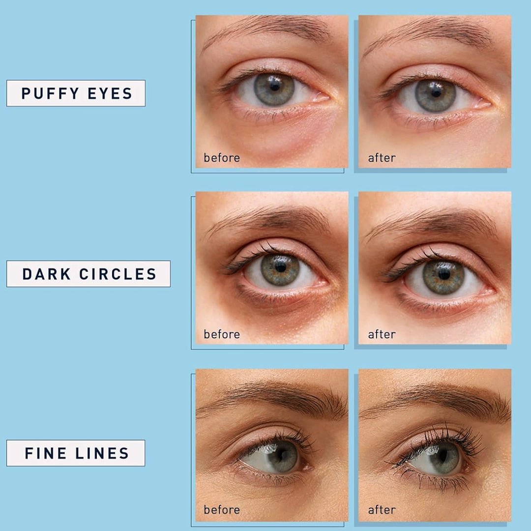 Under-Eye Patch with Escin packaging — dark circle & puffiness treatment, spa retail wholesale